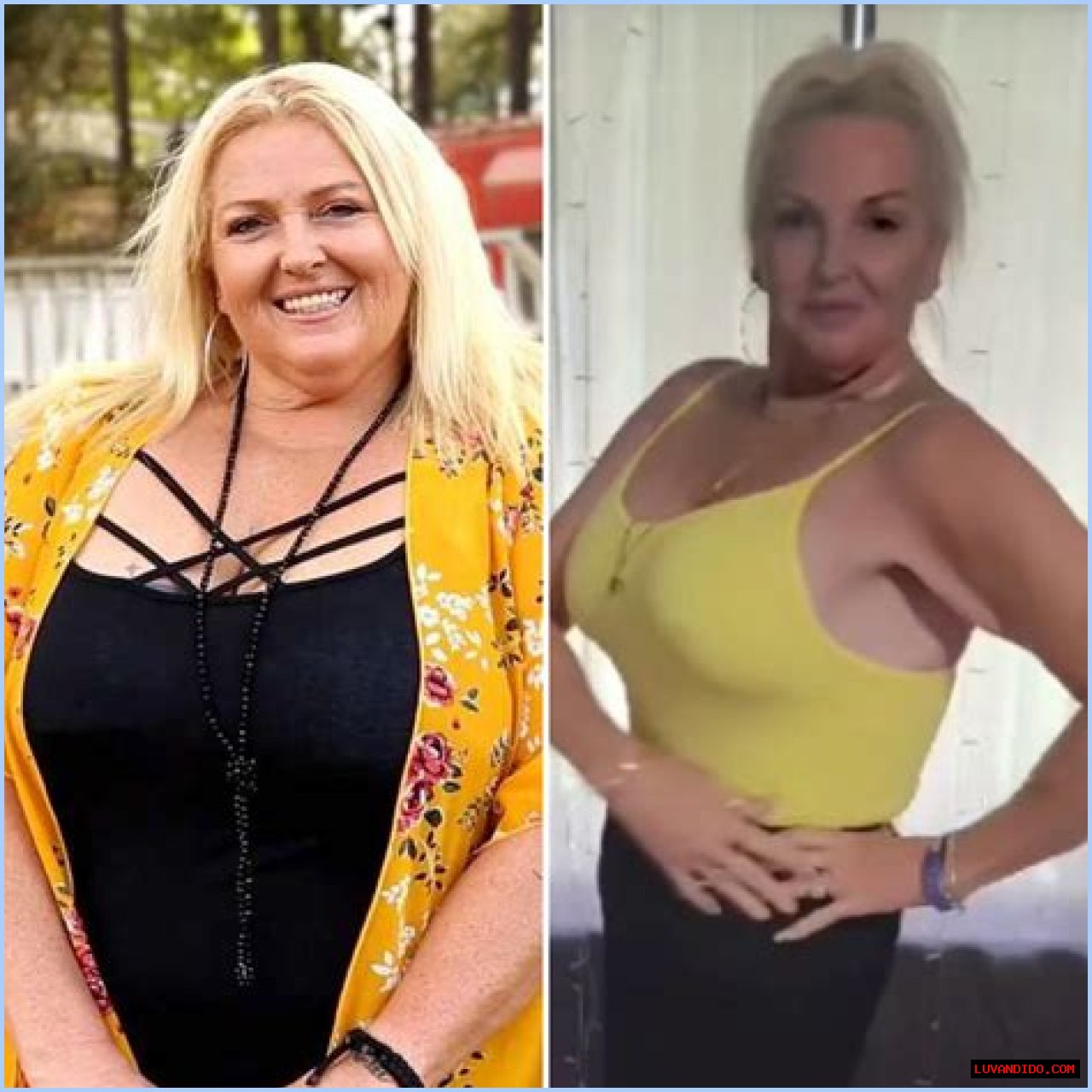 Angela Deem Had A Weight Loss Surgery And A Makeover